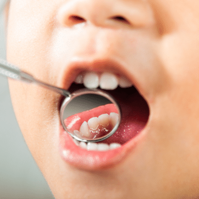 Rvapd tips for parents on caring for their children blog